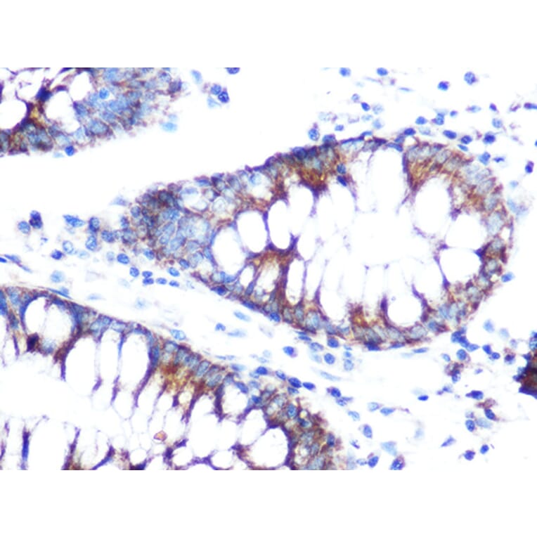 Immunohistochemistry - Anti-Folate Binding Protein/FBP Antibody (A92599) - Antibodies.com