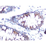 Immunohistochemistry - Anti-Folate Binding Protein/FBP Antibody (A92599) - Antibodies.com