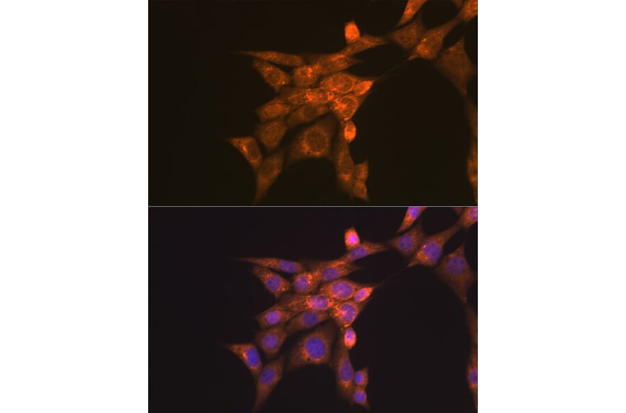 Immunofluorescence - Anti-Folate Binding Protein/FBP Antibody (A92599) - Antibodies.com