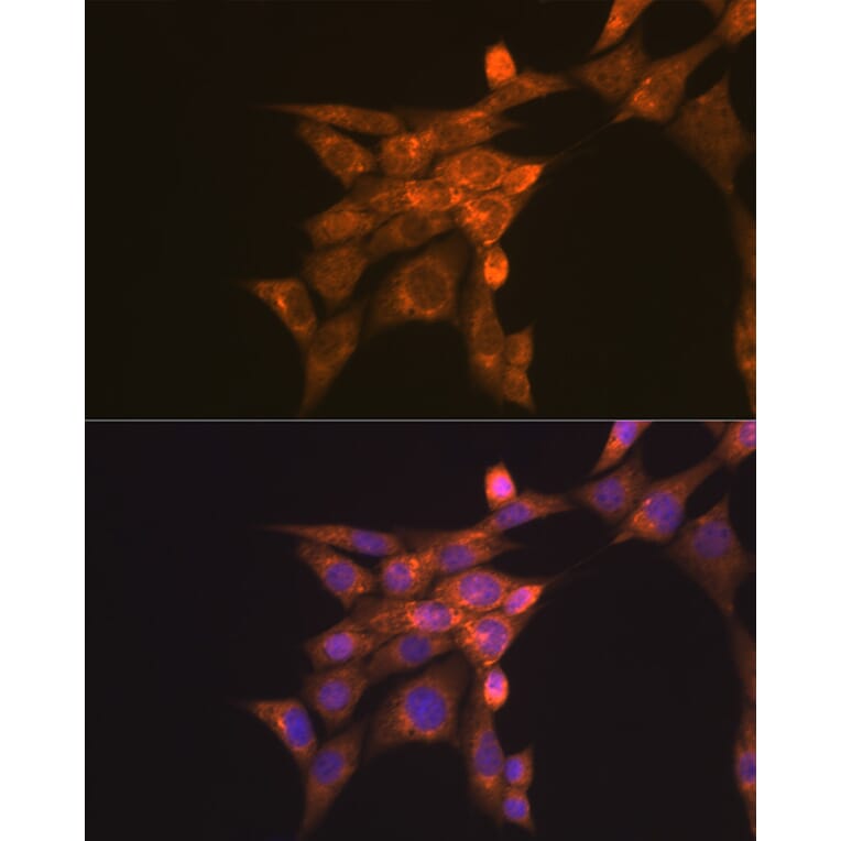Immunofluorescence - Anti-Folate Binding Protein/FBP Antibody (A92599) - Antibodies.com