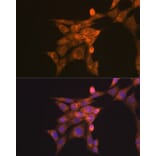 Immunofluorescence - Anti-Folate Binding Protein/FBP Antibody (A92599) - Antibodies.com