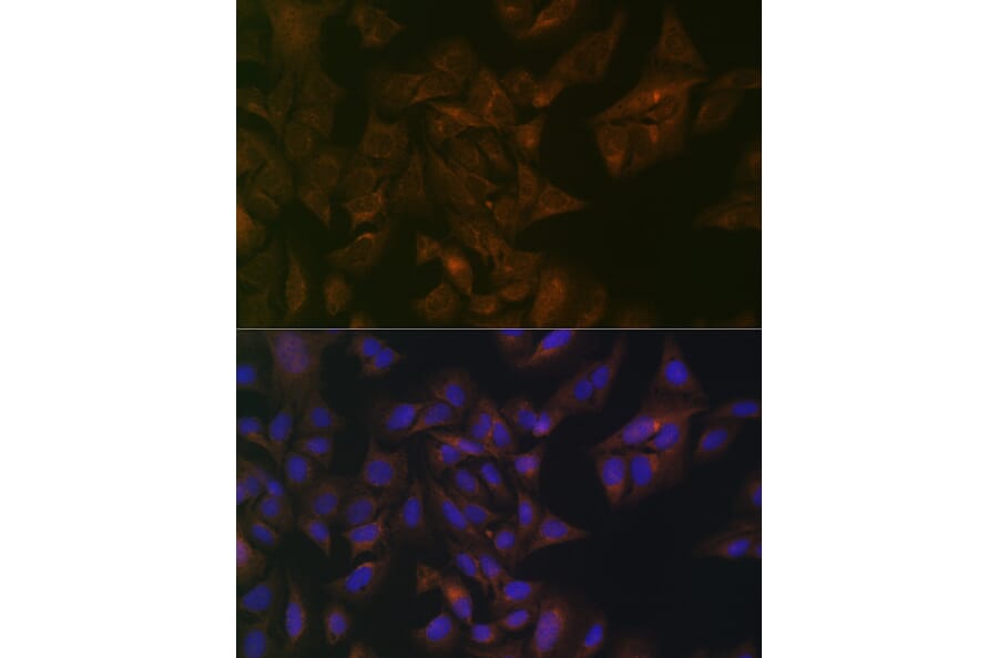 Immunofluorescence - Anti-Folate Binding Protein/FBP Antibody (A92599) - Antibodies.com