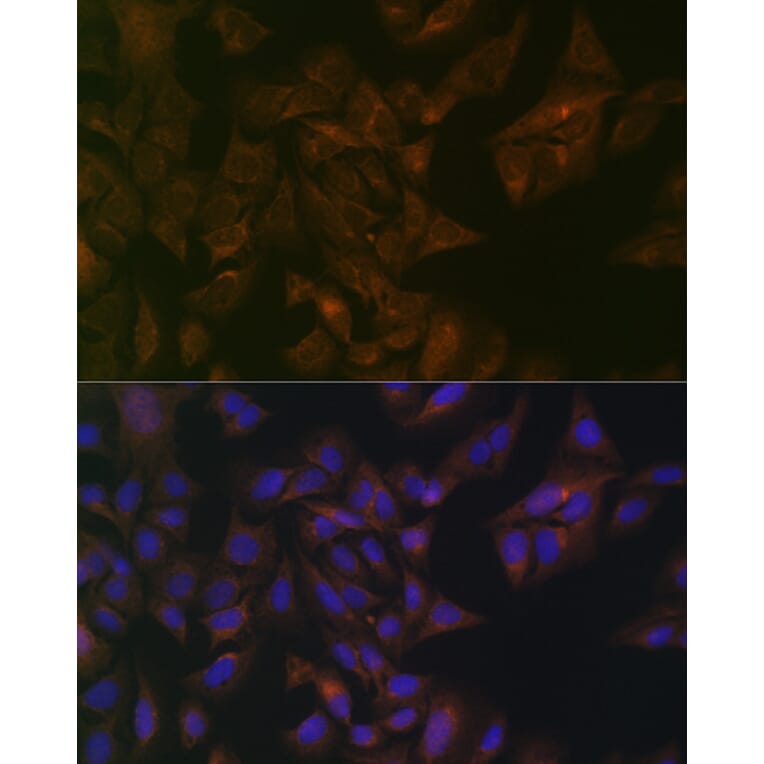 Immunofluorescence - Anti-Folate Binding Protein/FBP Antibody (A92599) - Antibodies.com