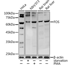 Western Blot - Anti-c-Fos Antibody (A92600) - Antibodies.com
