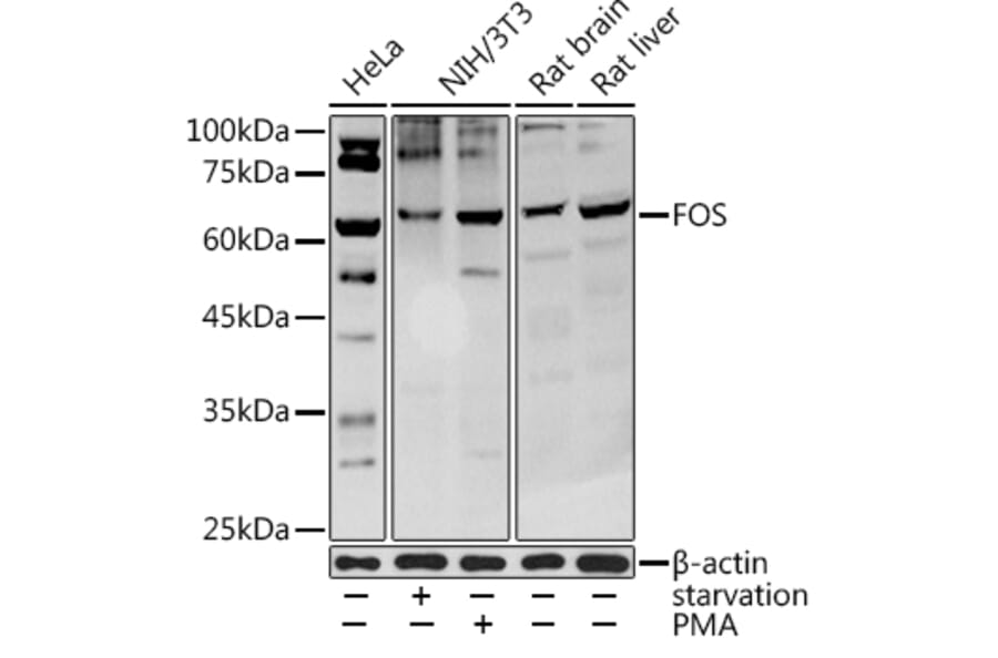Western Blot - Anti-c-Fos Antibody (A92600) - Antibodies.com