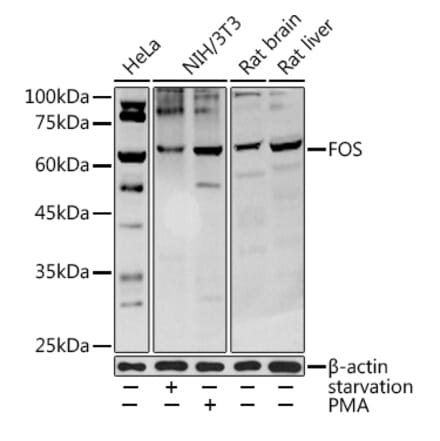 Western Blot - Anti-c-Fos Antibody (A92600) - Antibodies.com