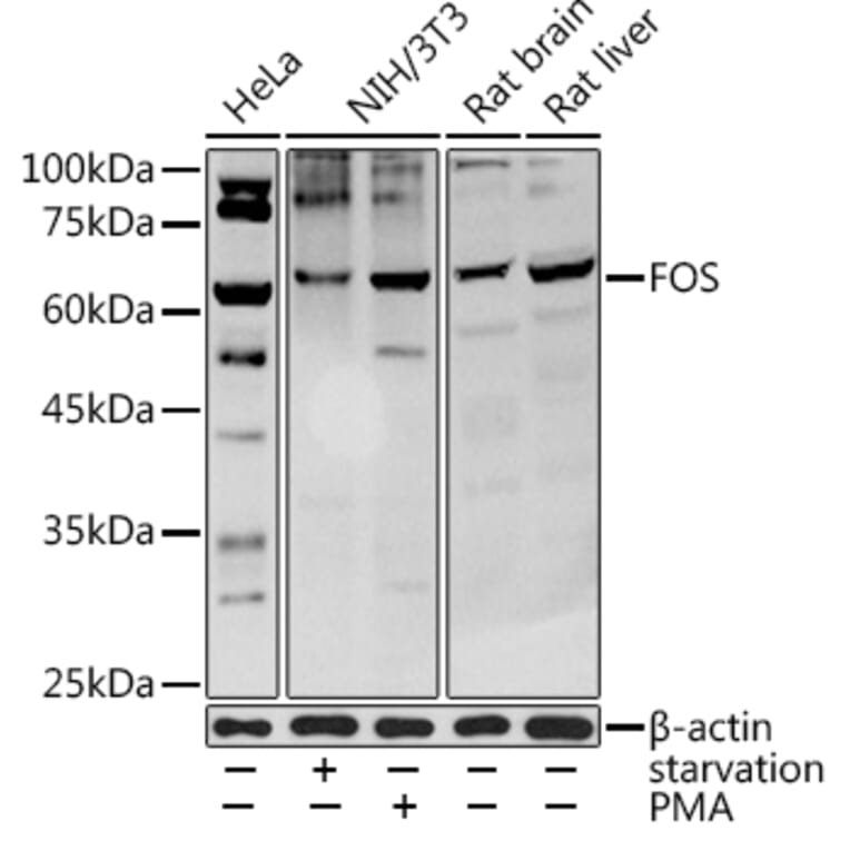 Western Blot - Anti-c-Fos Antibody (A92600) - Antibodies.com