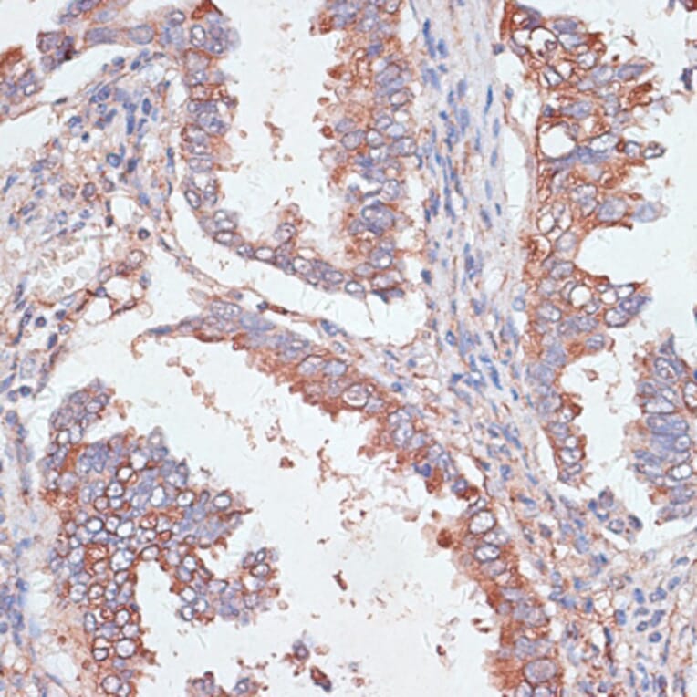 Immunohistochemistry - Anti-GAB1 Antibody (A92604) - Antibodies.com