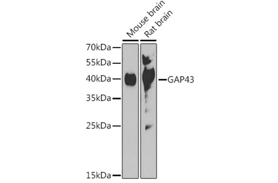 Western Blot - Anti-GAP43 Antibody (A92605) - Antibodies.com