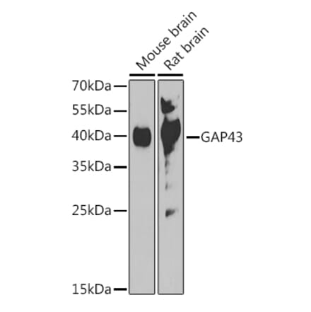 Western Blot - Anti-GAP43 Antibody (A92605) - Antibodies.com