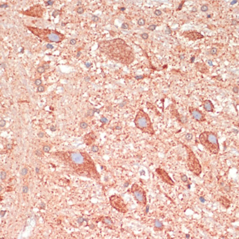 Immunohistochemistry - Anti-GAP43 Antibody (A92605) - Antibodies.com