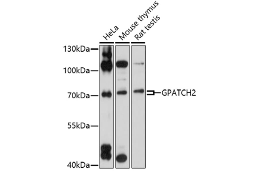 Western Blot - Anti-GPATCH2 Antibody (A92609) - Antibodies.com