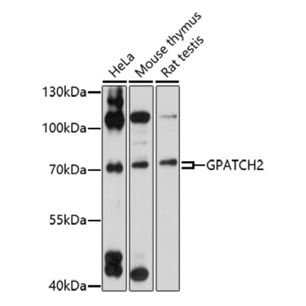 Western Blot - Anti-GPATCH2 Antibody (A92609) - Antibodies.com