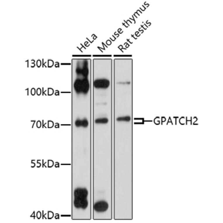 Western Blot - Anti-GPATCH2 Antibody (A92609) - Antibodies.com