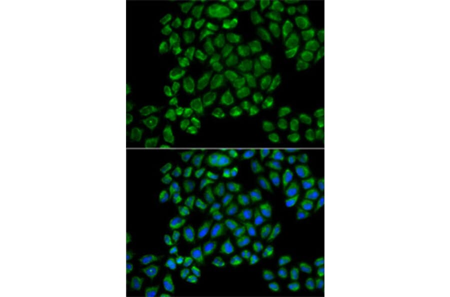 Immunofluorescence - Anti-Glutamate receptor 3/GluA3 Antibody (A92610) - Antibodies.com