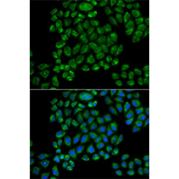 Immunofluorescence - Anti-Glutamate receptor 3/GluA3 Antibody (A92610) - Antibodies.com