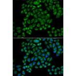 Immunofluorescence - Anti-Glutamate receptor 3/GluA3 Antibody (A92610) - Antibodies.com