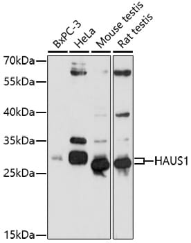 Western blot analysis of extracts of various cell lines, using Anti-HAUS1 Antibody (A17250) at 1:1,000 dilution.
Secondary antibody: Goat Anti-Rabbit IgG (H+L) (HRP) (AS014) at 1:10,000 dilution.
Lysates / proteins: 25µg per lane.
Blocking buffer: 3% non-fat dry milk in TBST.
Detection: ECL Basic Kit (RM00020).
Exposure time: 90s.