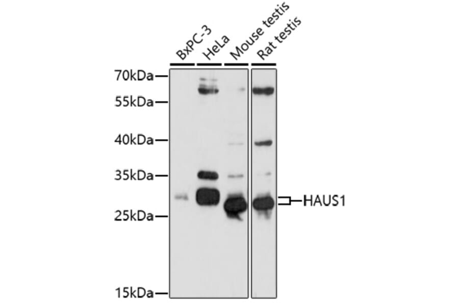 Western Blot - Anti-CCDC5 Antibody (A92611) - Antibodies.com