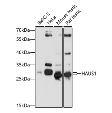 Western Blot - Anti-CCDC5 Antibody (A92611) - Antibodies.com