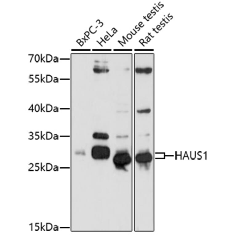 Western Blot - Anti-CCDC5 Antibody (A92611) - Antibodies.com