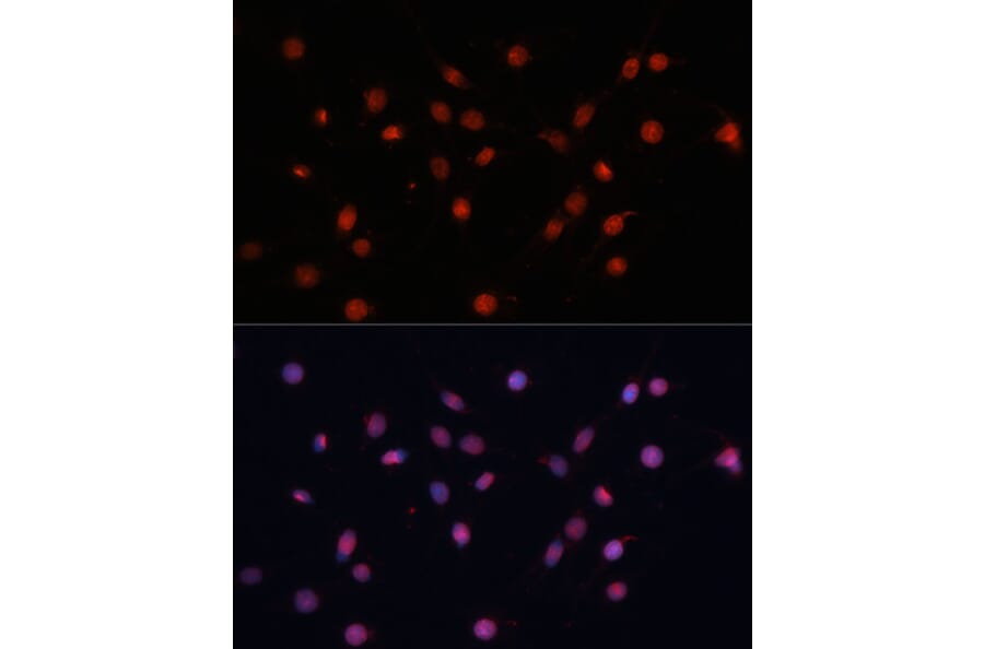 Immunofluorescence - Anti-HIF1A Antibody (A16873) - Antibodies.com