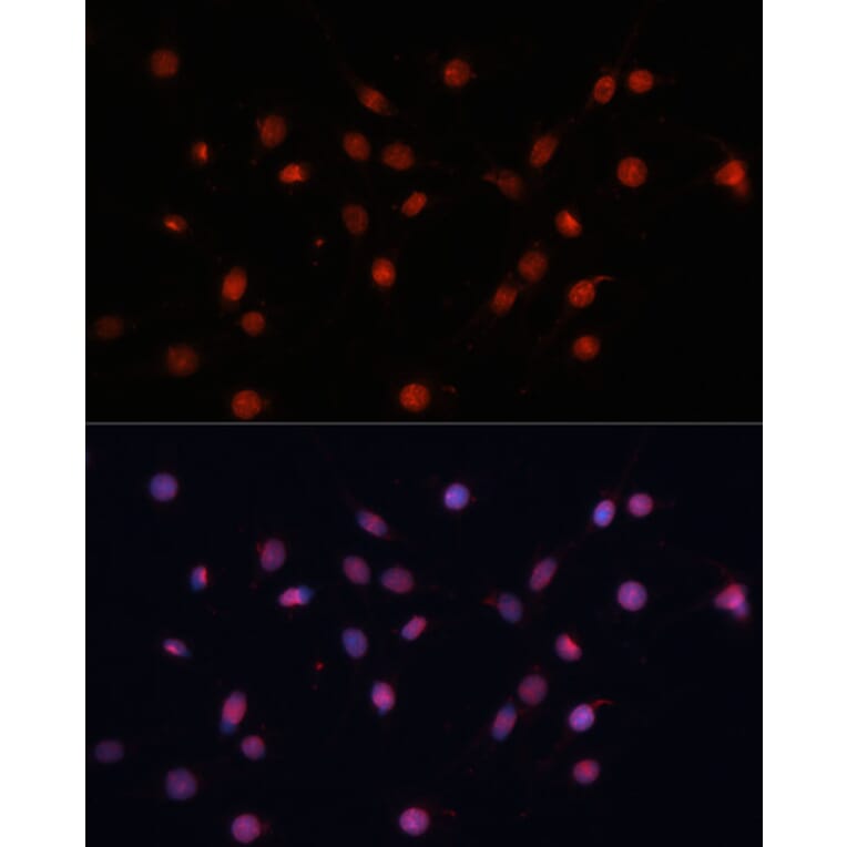 Immunofluorescence - Anti-HIF1A Antibody (A16873) - Antibodies.com