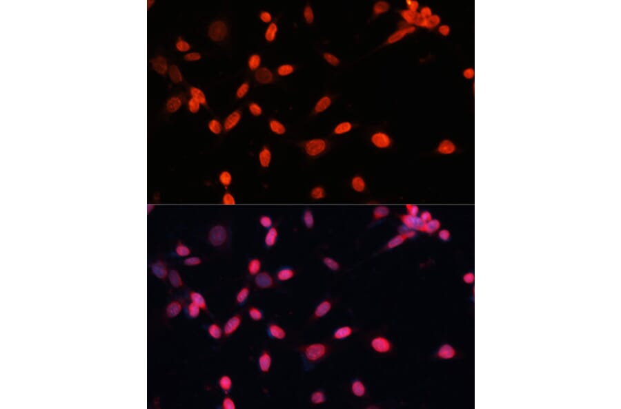 Immunofluorescence - Anti-HIF1A Antibody (A16873) - Antibodies.com