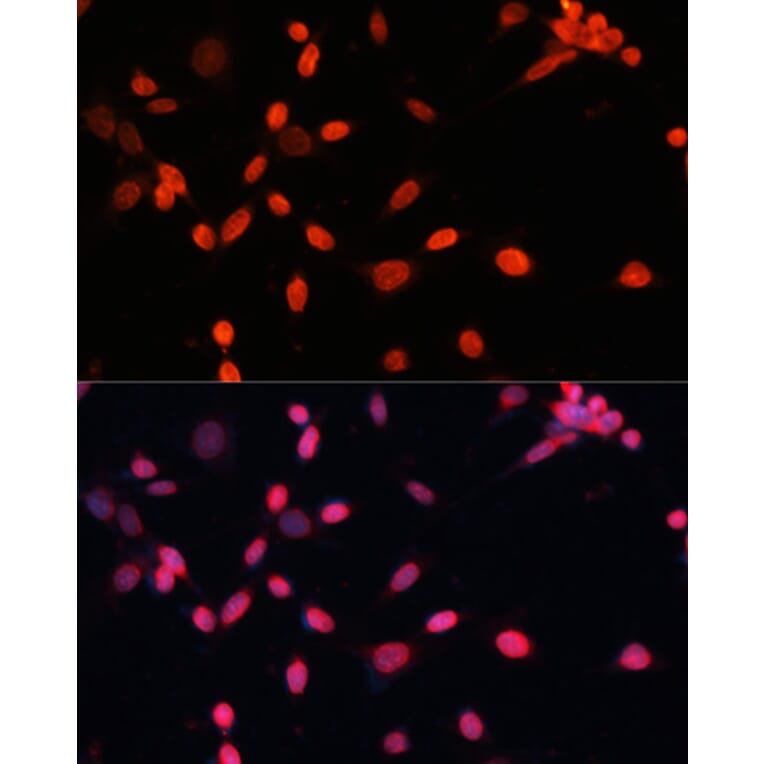 Immunofluorescence - Anti-HIF1A Antibody (A16873) - Antibodies.com