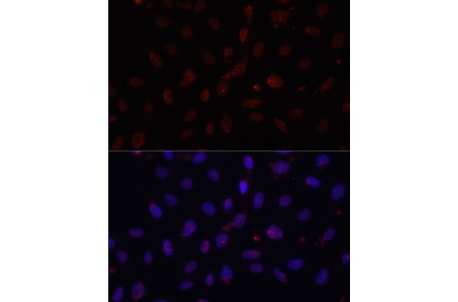 Immunofluorescence - Anti-HIF1A Antibody (A16873) - Antibodies.com
