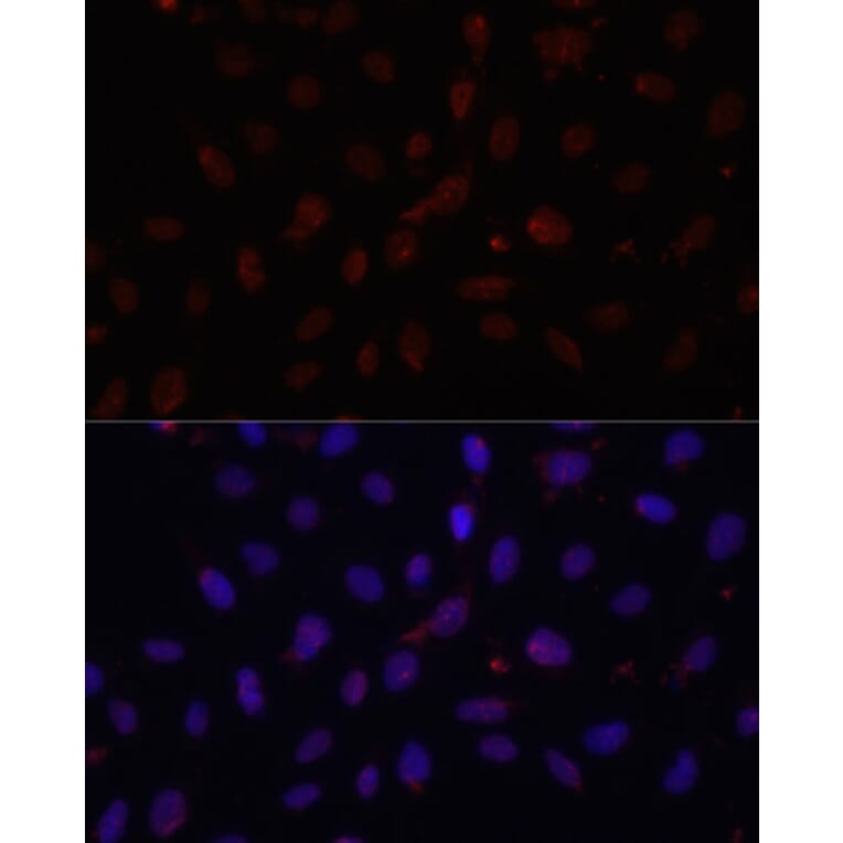 Immunofluorescence - Anti-HIF1A Antibody (A16873) - Antibodies.com