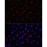 Immunofluorescence - Anti-HIF1A Antibody (A16873) - Antibodies.com