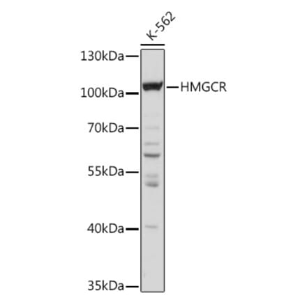 Western Blot - Anti-HMGCR Antibody (A92614) - Antibodies.com