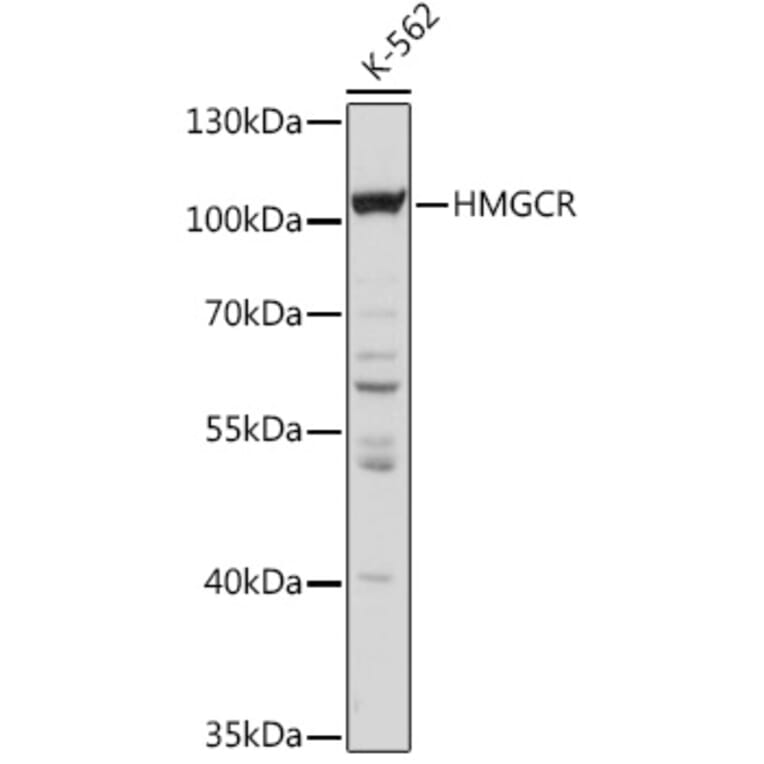 Western Blot - Anti-HMGCR Antibody (A92614) - Antibodies.com