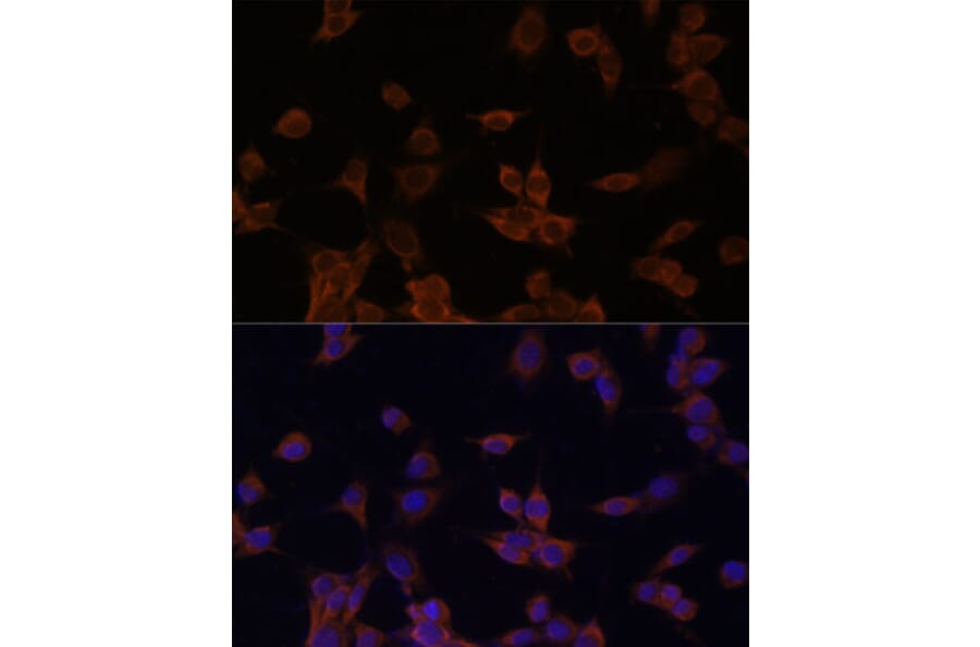 Immunofluorescence - Anti-HMGCR Antibody (A92614) - Antibodies.com