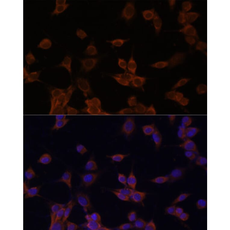 Immunofluorescence - Anti-HMGCR Antibody (A92614) - Antibodies.com