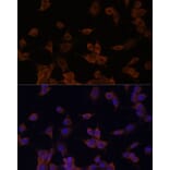 Immunofluorescence - Anti-HMGCR Antibody (A92614) - Antibodies.com