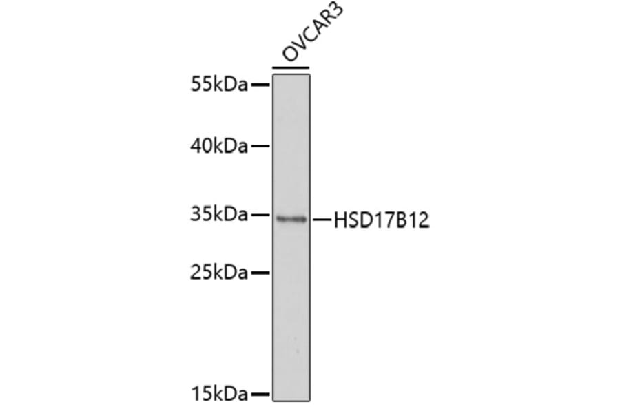 Western Blot - Anti-KAR Antibody (A92615) - Antibodies.com