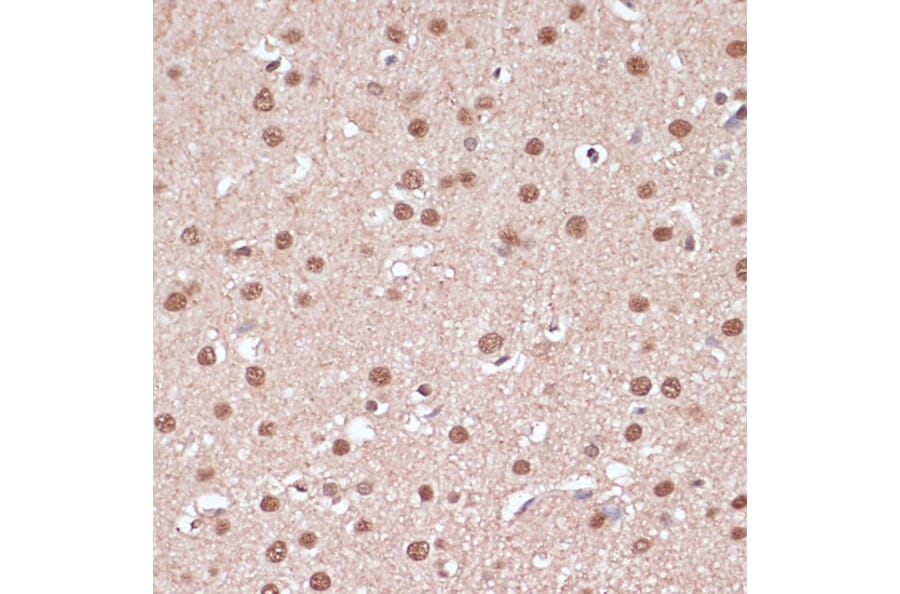 Immunohistochemistry - Anti-ITCH/AIP4 Antibody (A92619) - Antibodies.com
