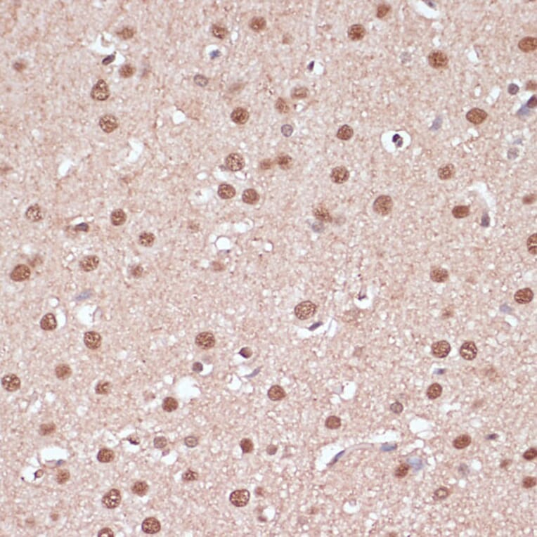 Immunohistochemistry - Anti-ITCH/AIP4 Antibody (A92619) - Antibodies.com