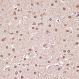 Immunohistochemistry - Anti-ITCH/AIP4 Antibody (A92619) - Antibodies.com