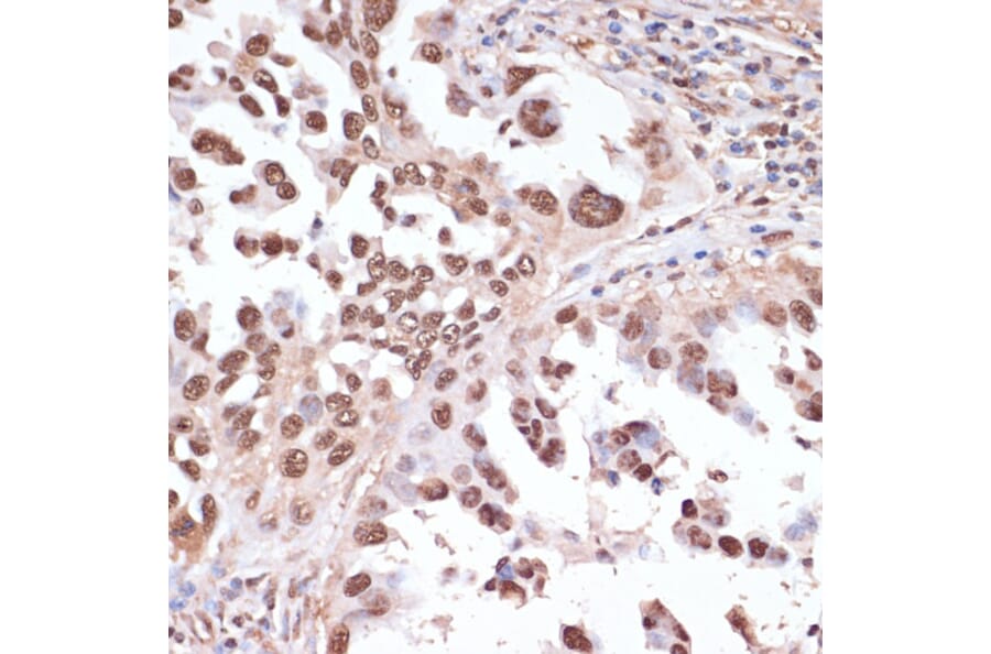 Immunohistochemistry - Anti-ITCH/AIP4 Antibody (A92619) - Antibodies.com