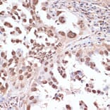 Immunohistochemistry - Anti-ITCH/AIP4 Antibody (A92619) - Antibodies.com