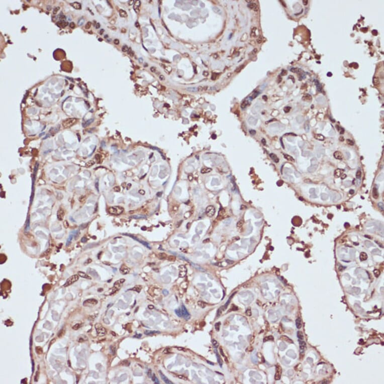Immunohistochemistry - Anti-ITCH/AIP4 Antibody (A92619) - Antibodies.com