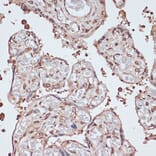 Immunohistochemistry - Anti-ITCH/AIP4 Antibody (A92619) - Antibodies.com