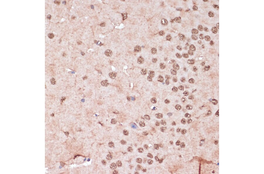 Immunohistochemistry - Anti-ITCH/AIP4 Antibody (A92619) - Antibodies.com