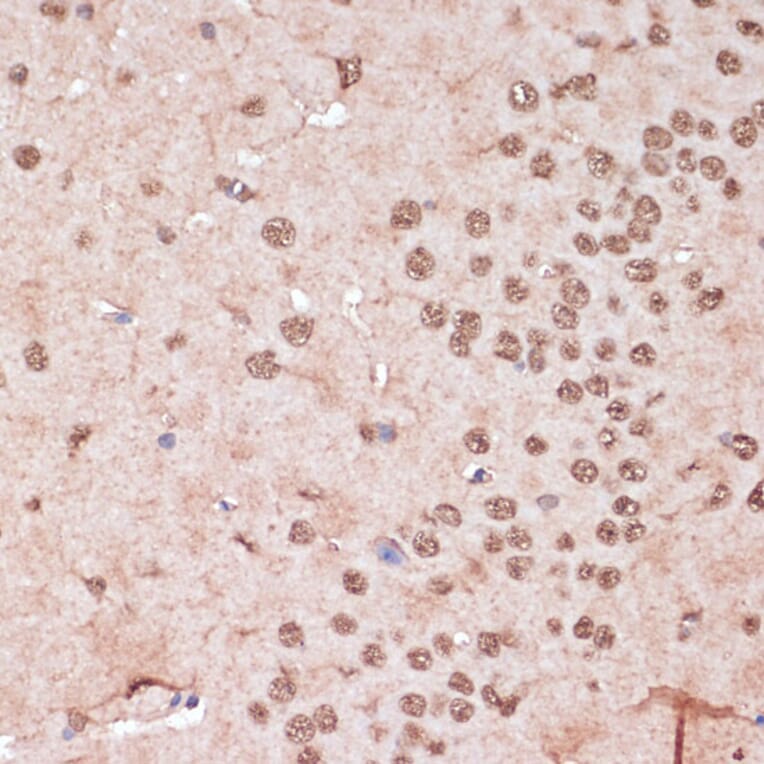 Immunohistochemistry - Anti-ITCH/AIP4 Antibody (A92619) - Antibodies.com