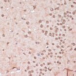 Immunohistochemistry - Anti-ITCH/AIP4 Antibody (A92619) - Antibodies.com