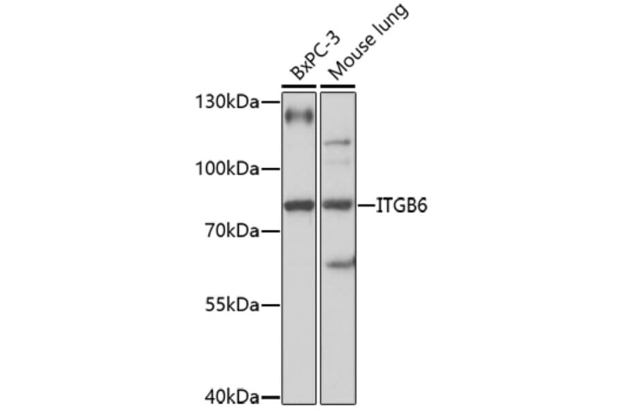 Western Blot - Anti-ITGB6 Antibody (A92620) - Antibodies.com