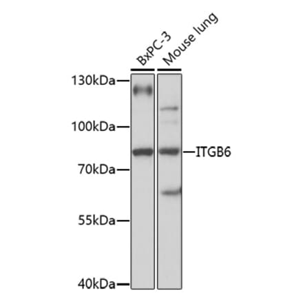 Western Blot - Anti-ITGB6 Antibody (A92620) - Antibodies.com